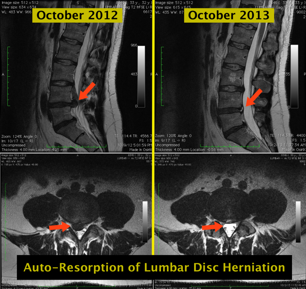 The Stable Spine Series Part 4: X-Rays, MRI's...Dangerous for a Bad ...