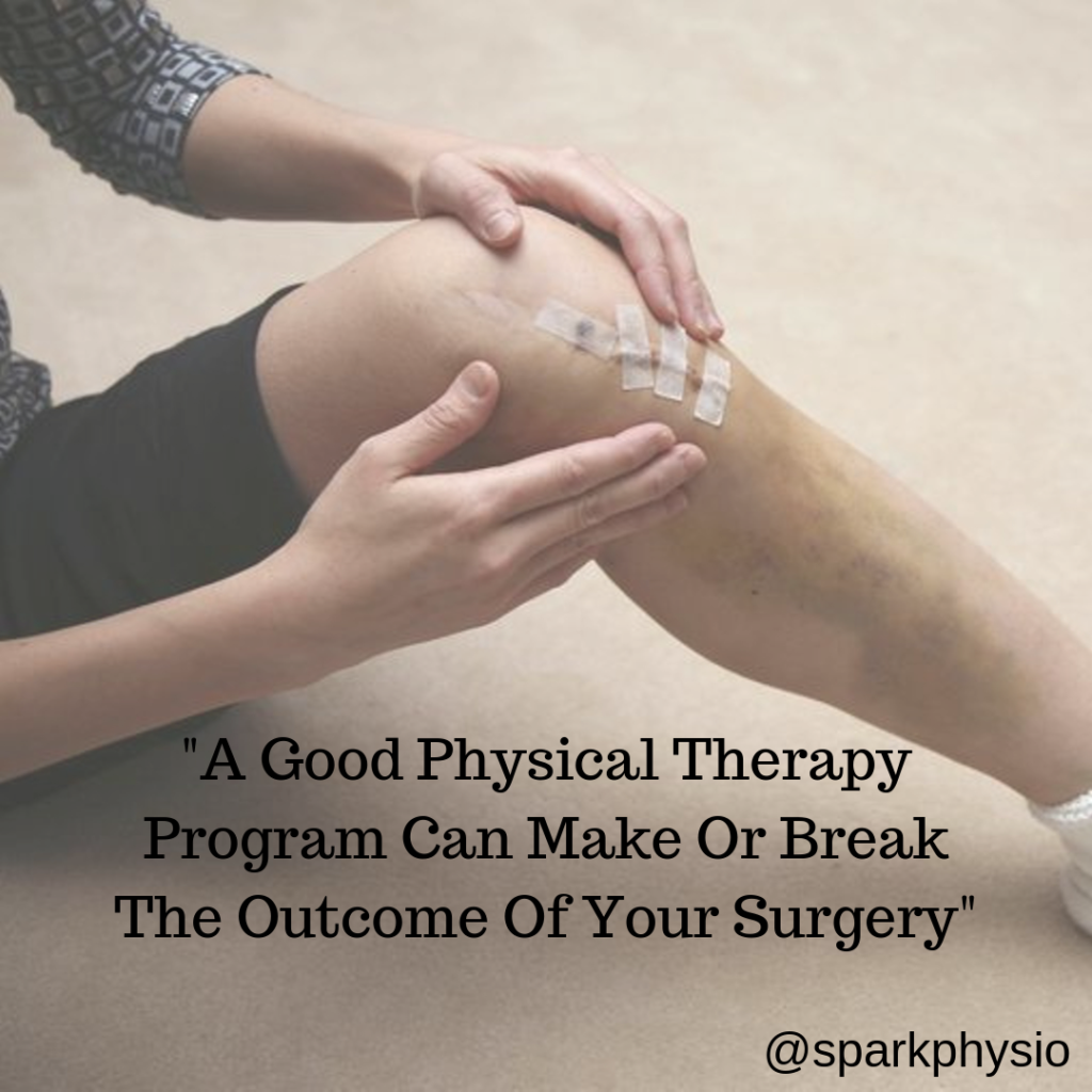 physical-therapy-after-surgery-spark-performance-and-physiotherapy