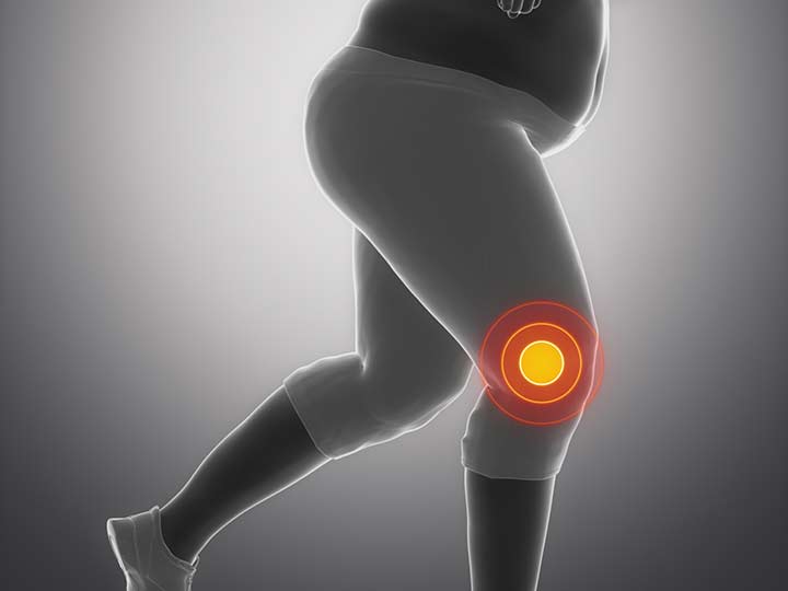 When It Comes To Knee Pain, Lighten Your Load